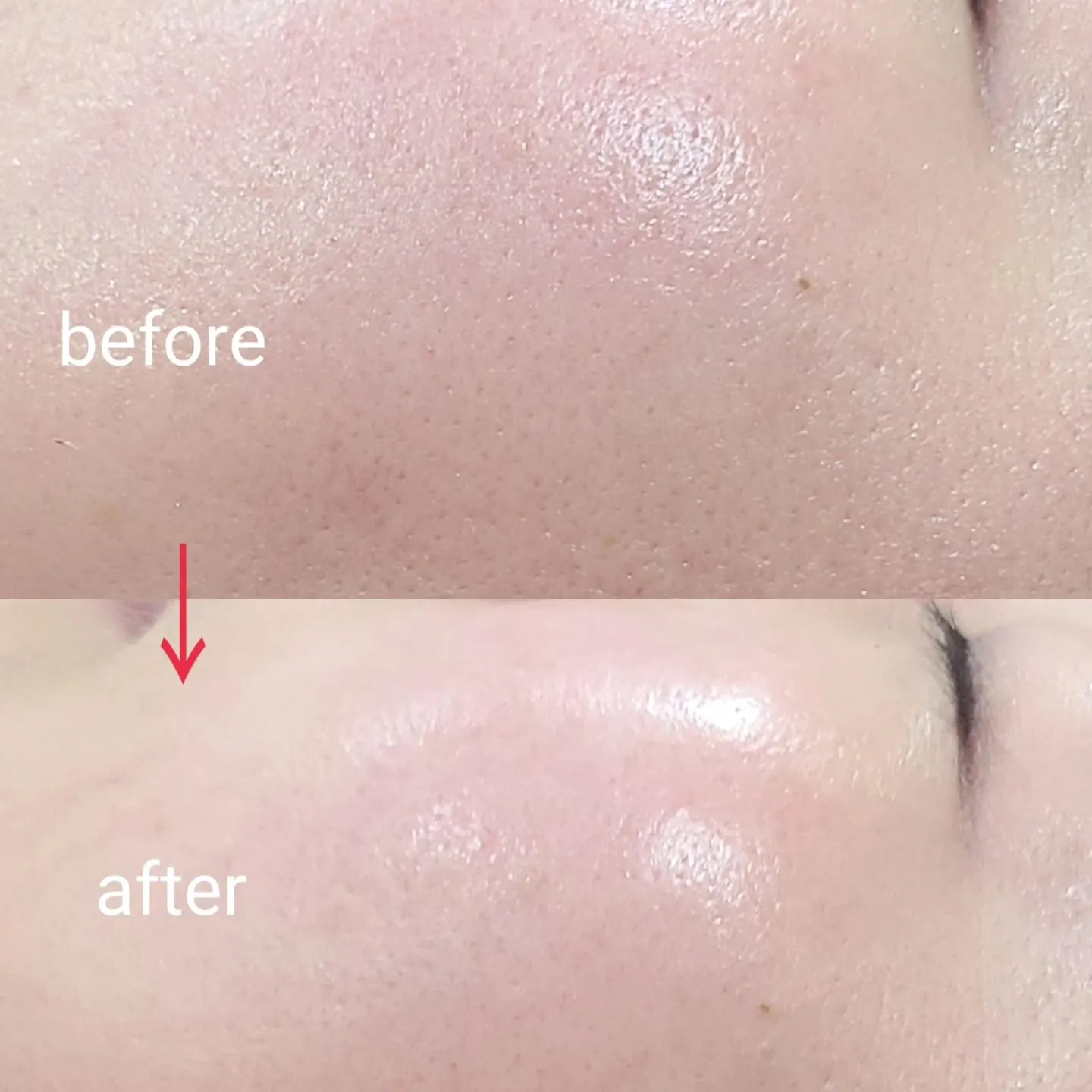 Merciのリブセラフェイシャル